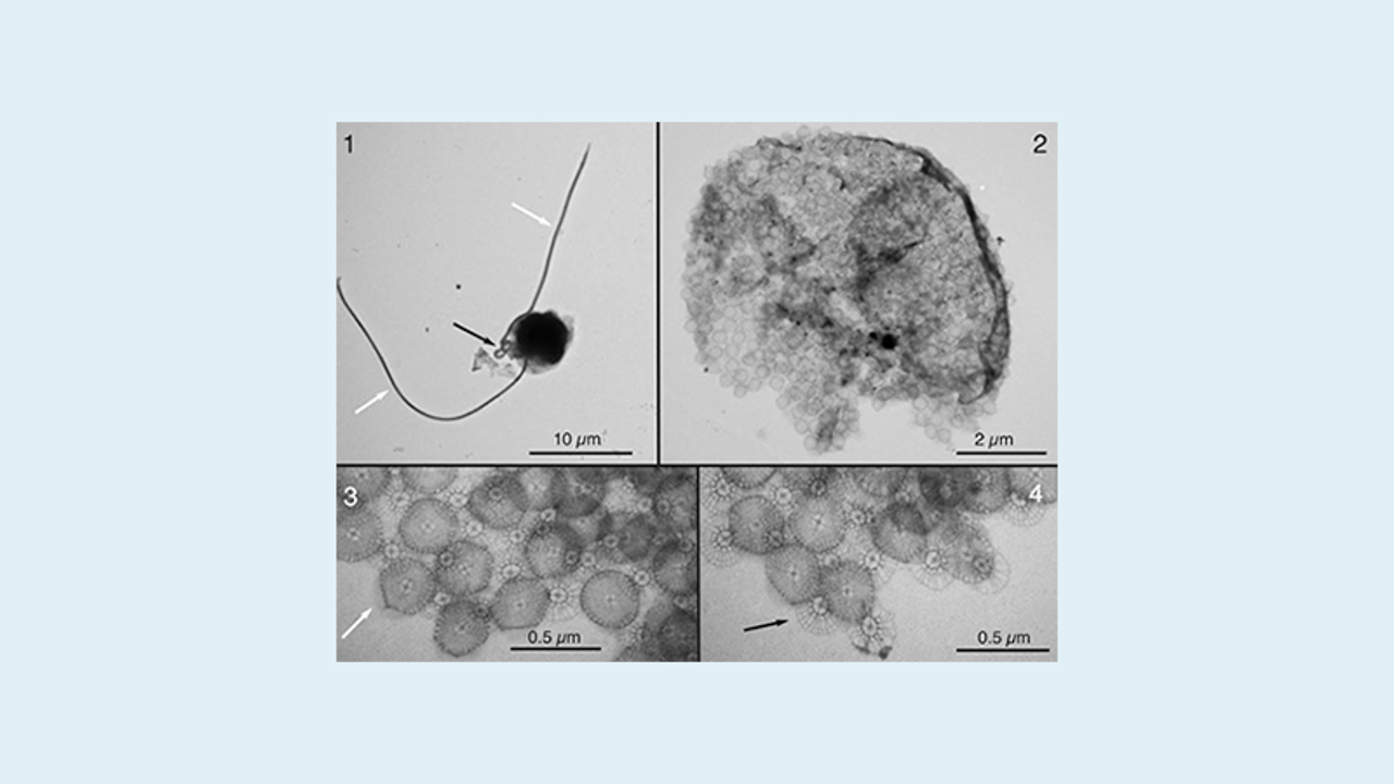 Chrysochromulina Leadbeateri2019 2