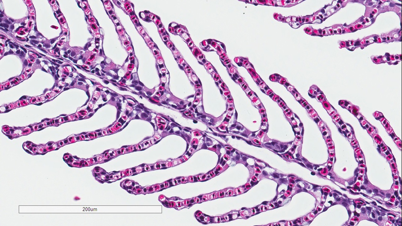 Normal Gill Tissue (1)