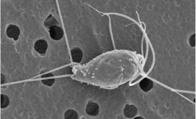 Spironucleus Salmonicida Foto Erik Sterud